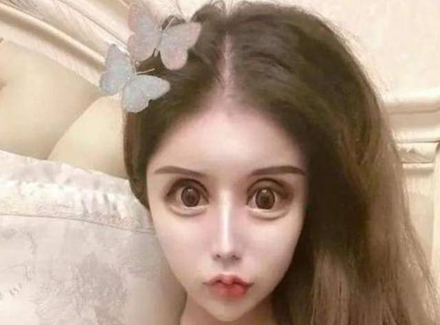 "花费近百万",三年动了60次的网红女孩现在咋样?简直判若两人