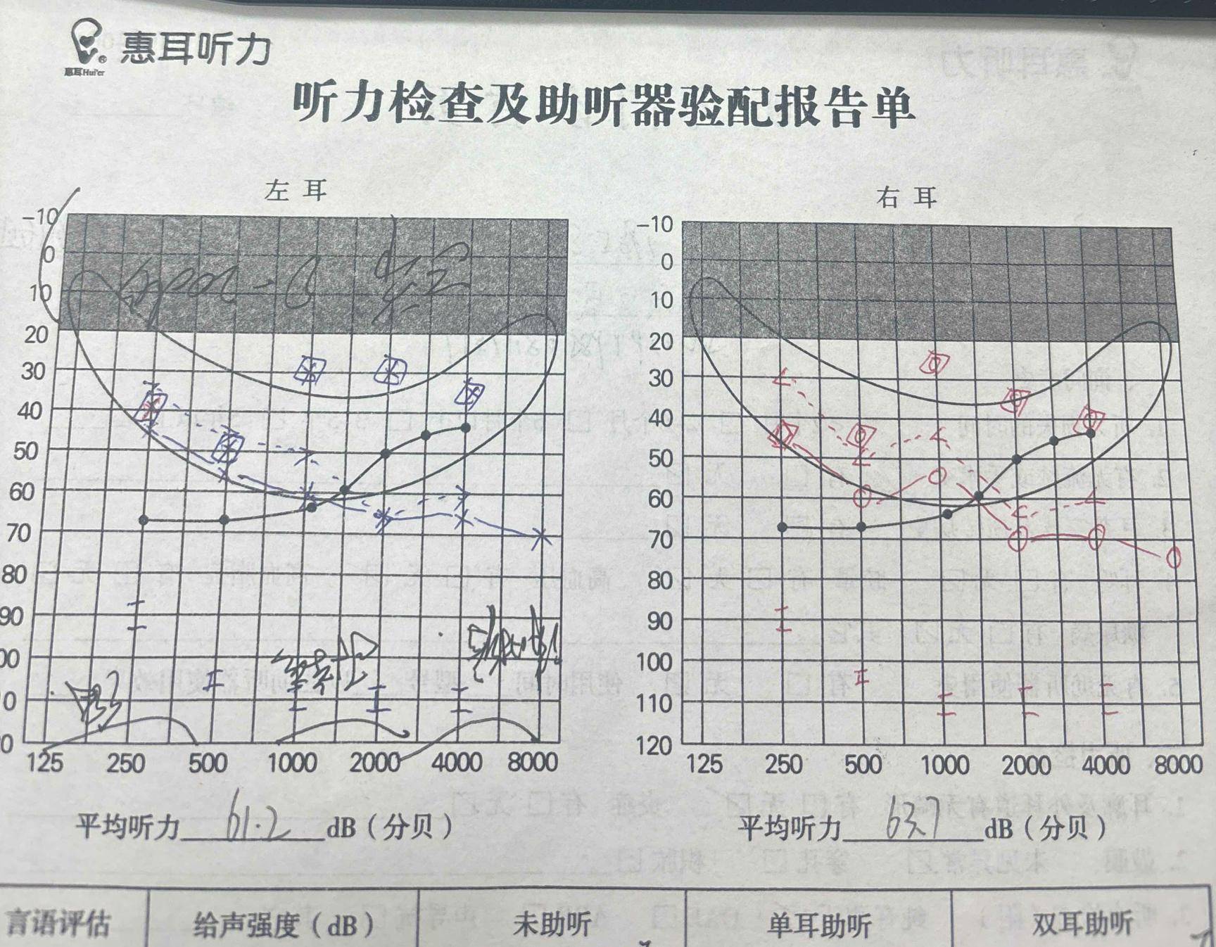 宝宝听力发育图1～12月图片