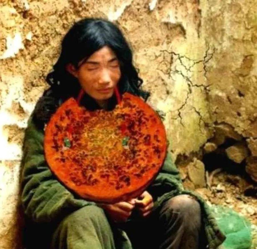 河南第一懒人杨锁:8岁还不会走路,吃饭全靠喂,23岁懒死在家中