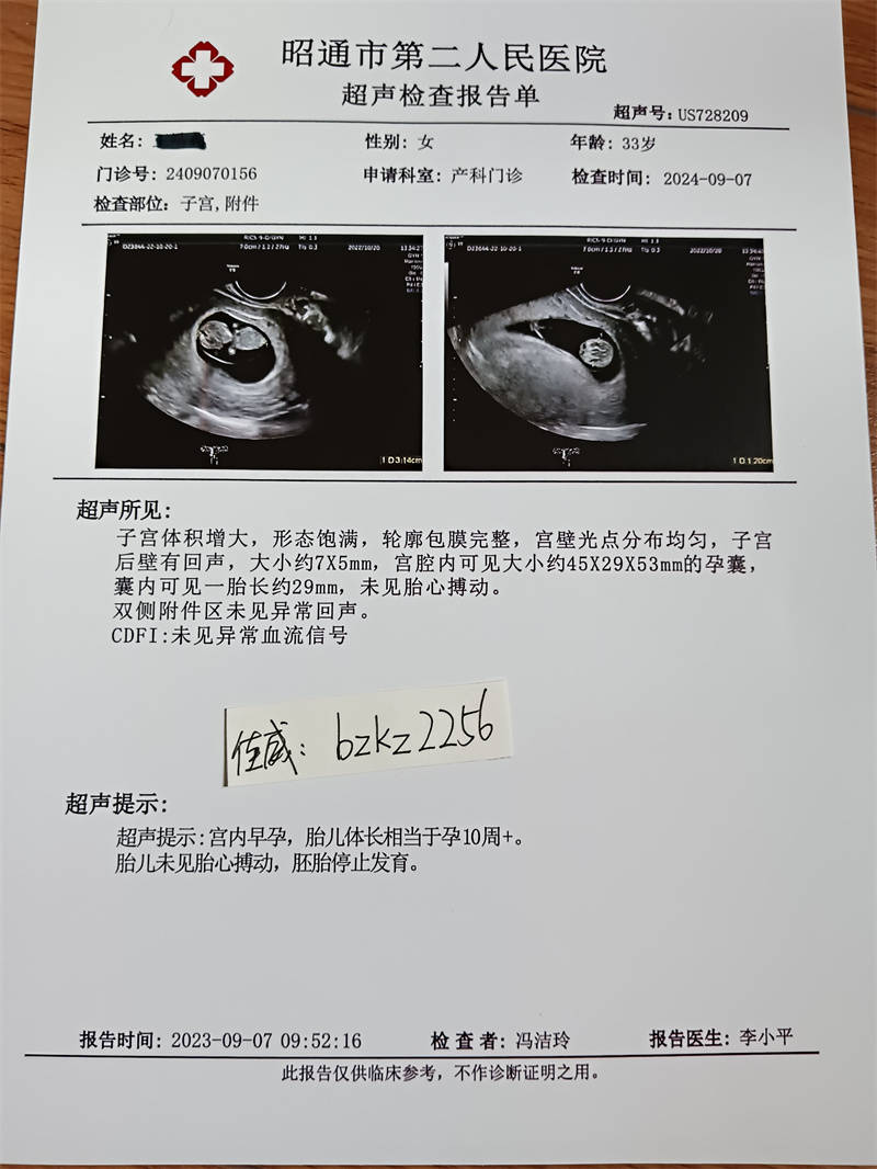 b超单孕检报告单早孕b超怀孕单子图b超单孕检报告单早孕b超怀孕单子图