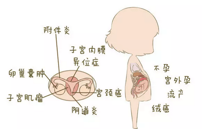 女性妇科疾病常见的症状有哪些,出现这几点需要去医院治疗!