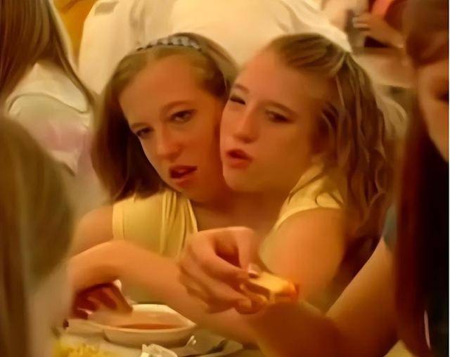 纪实美国双头连体姐妹共生34年,其中一位结婚!网友:另一位咋办