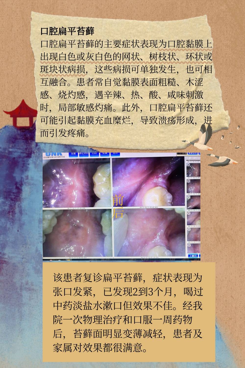 常见的口腔黏膜疾病你知道几个?