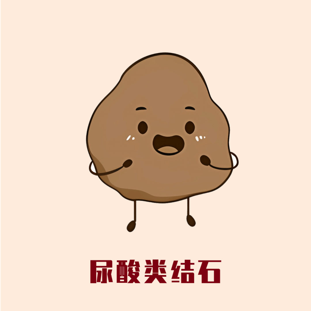 合肥中山结石医院:不同泌尿系结石咋应对?解锁 "破石" 正确姿势