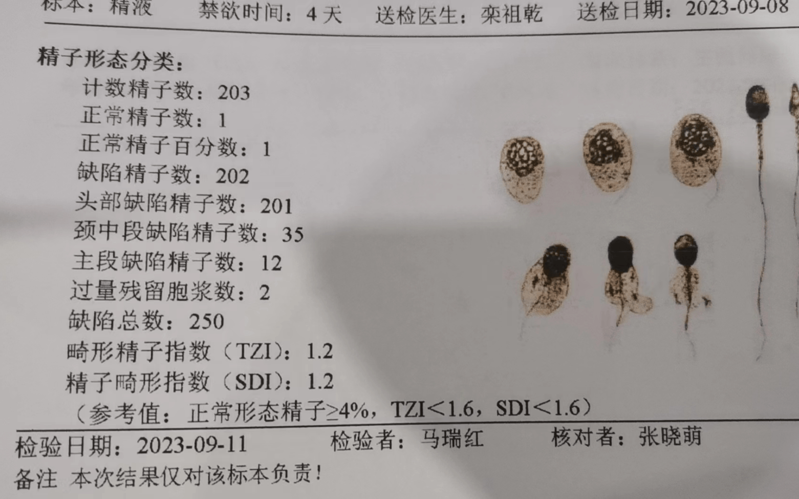欣易康达育欣套餐,精子碎片率高38,调后已经生欣易康达宝宝