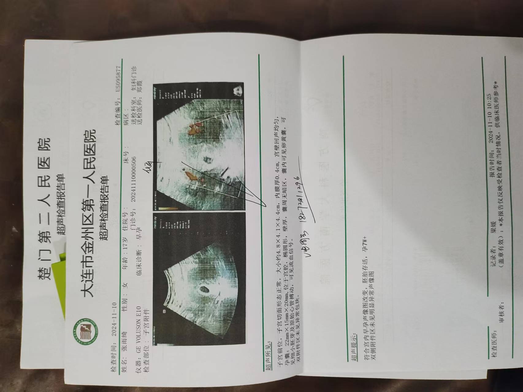 内分泌失调诊断功能评估,免疫系统检测以及生殖道超声波检查