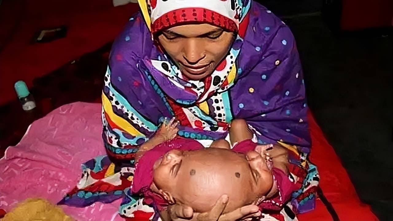 连体人如何结婚生子?19世纪泰国兄弟娶了亲姐妹花,生了22个孩子