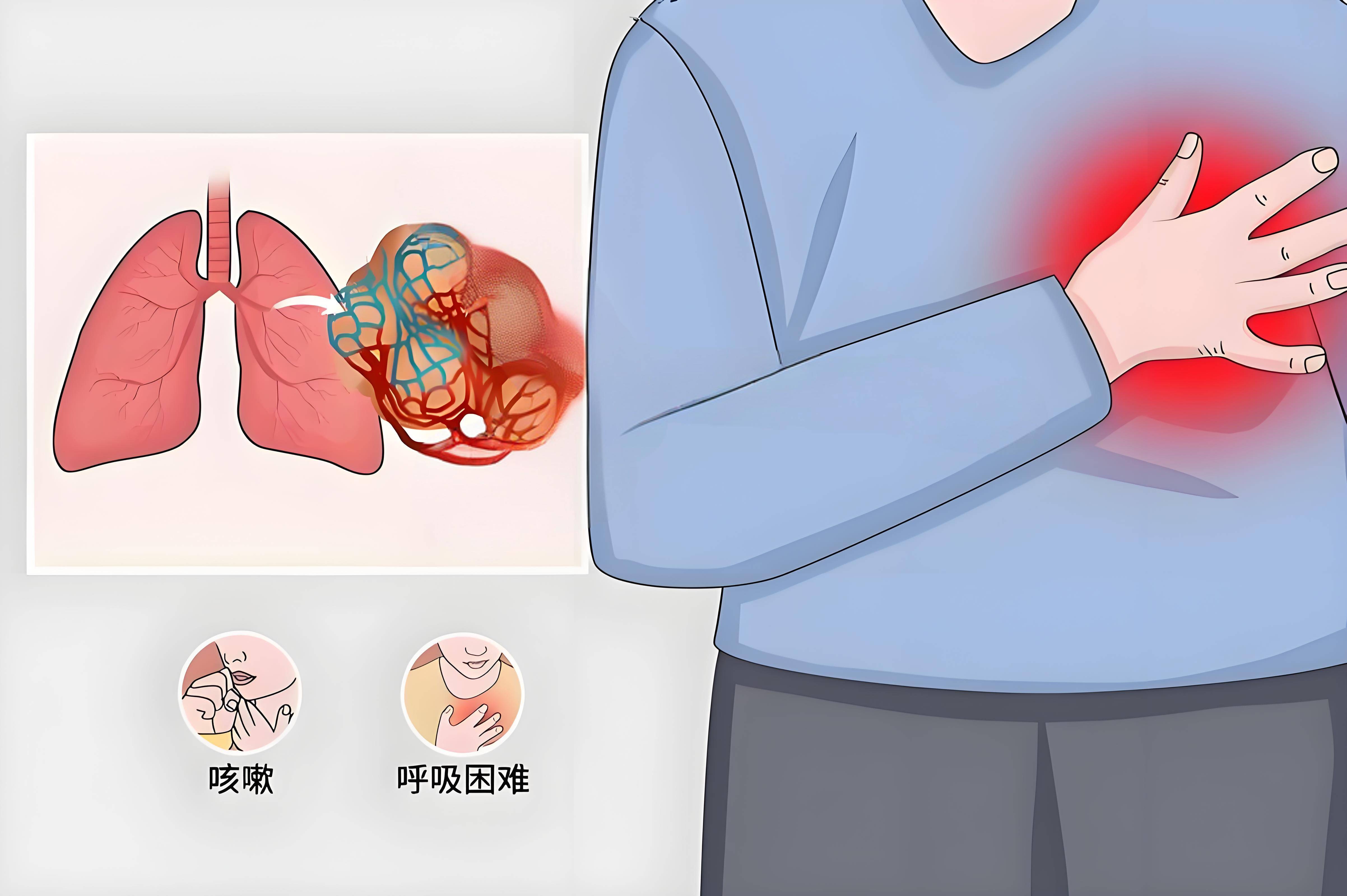 运动神经元病呼吸“暗箭”：从早期潜伏到晚期绝境，如何提前识破？-腾渊科技论坛
