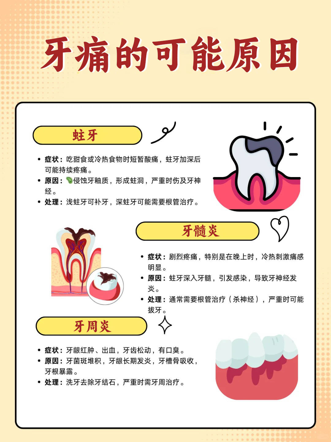 牙神经为什么会疼