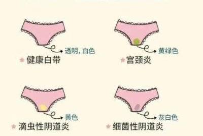 当你发现白带颜色不对，该怎么办？