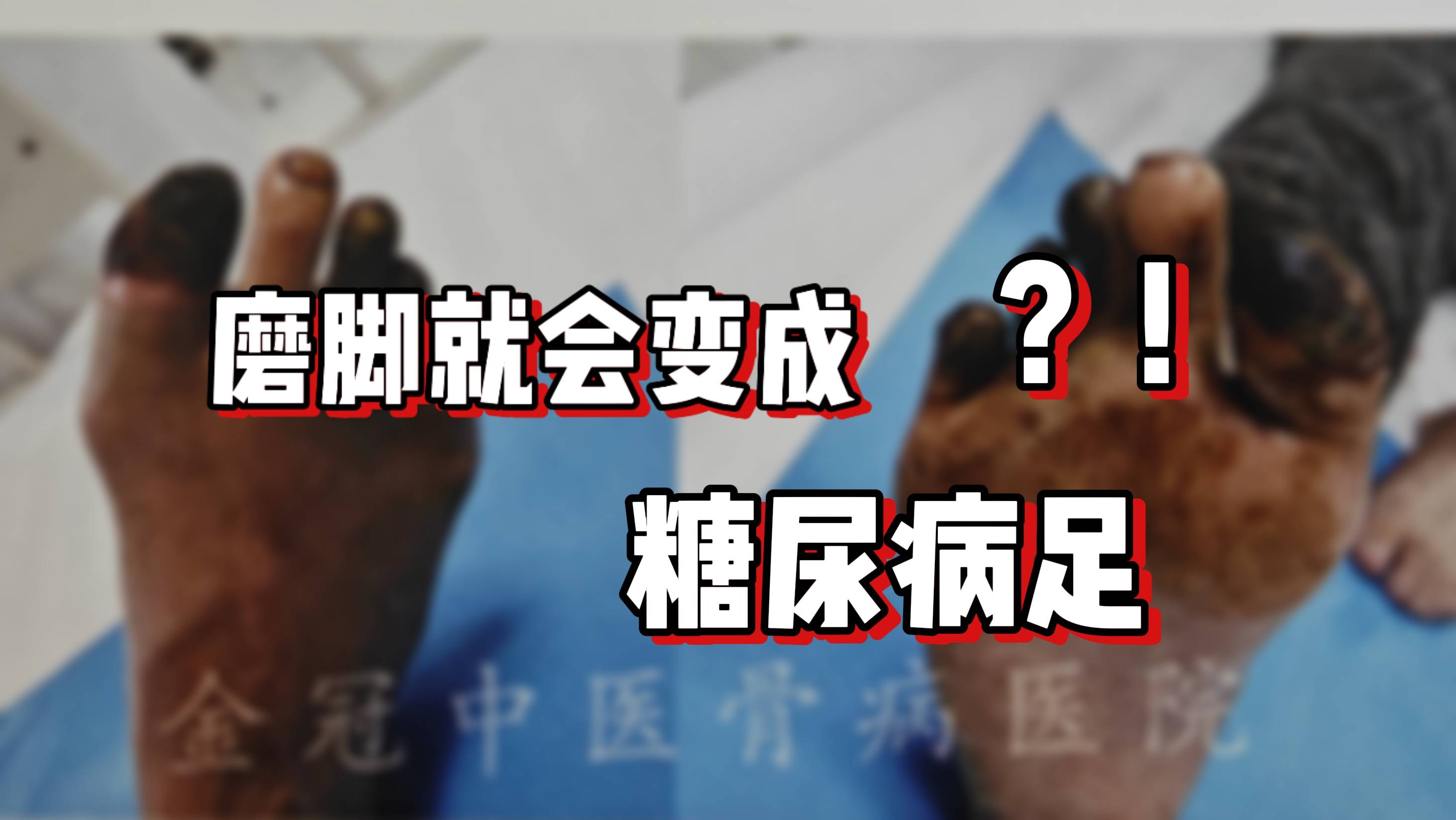 一次小小的磨脚，为何会演变成糖尿病足溃疡？