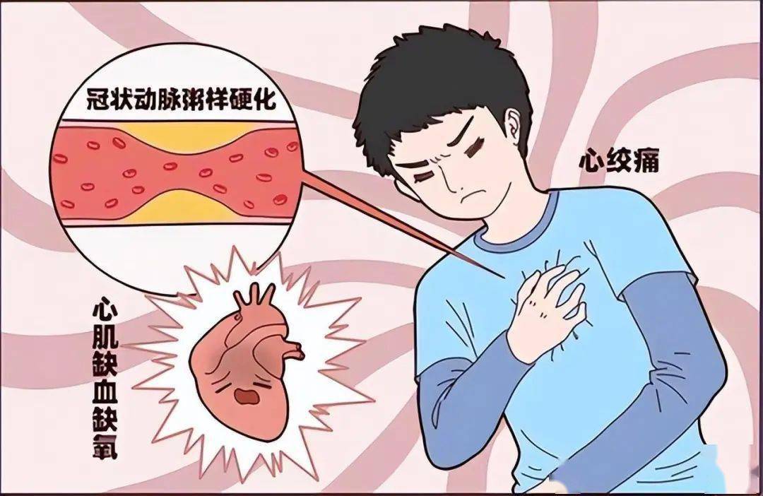 提醒:降低心衰风险,关键要做好这2件事_心脏_运动_因素