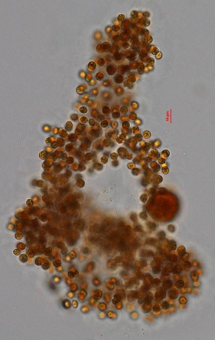 原来,洱海里的蓝藻长这样……_藻类_优势_束丝藻