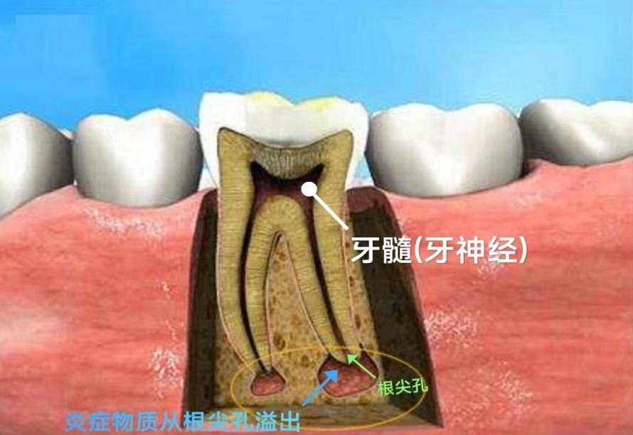 牙齿内部有牙髓组织