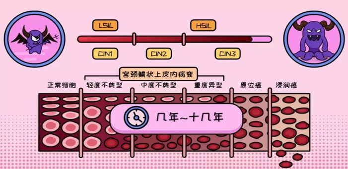 【重醫三院|健康科普】早發現 早治療,關愛她健康 癌