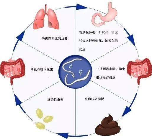 一類被忽視的熱帶病——土源性線蟲病_寄生蟲_蟯蟲