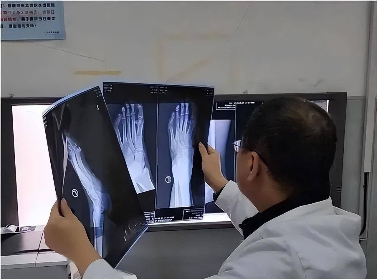 必须做手术吗?_膝关节_运动_膝盖