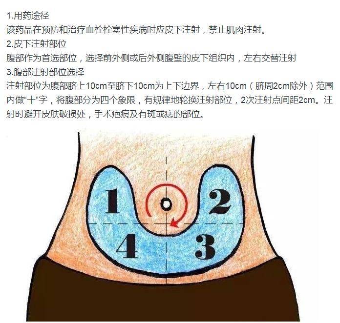 肝素大肚子的位置图图片