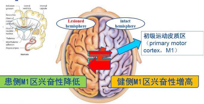 运动皮层m1区体表定位图片