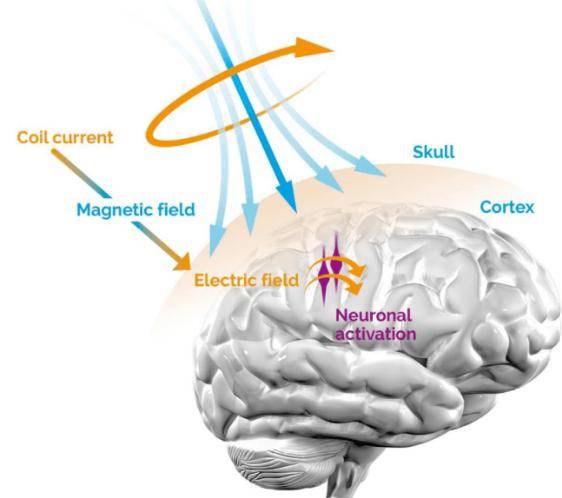 重复经颅磁刺激(repetitive transcranial magnetic stimulation,rtms