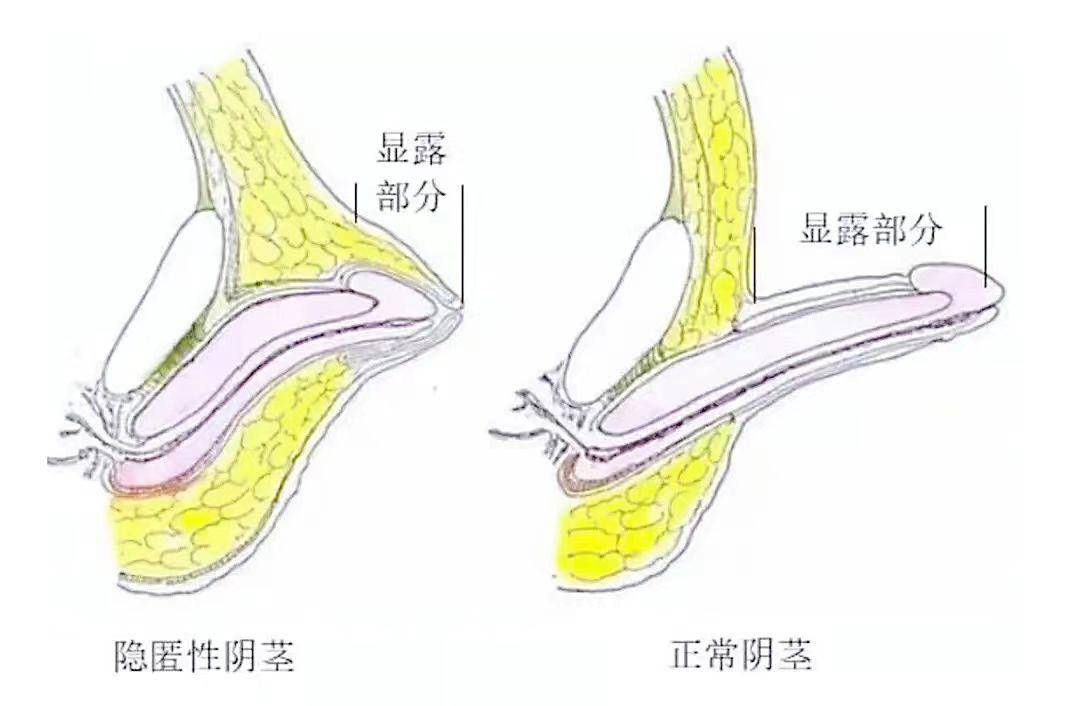 丁丁太小照片曝光图片