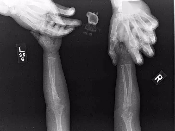 这是一条刚进餐的蛇一名"多齿症"患者的x光片当你是一位抢镜大师的