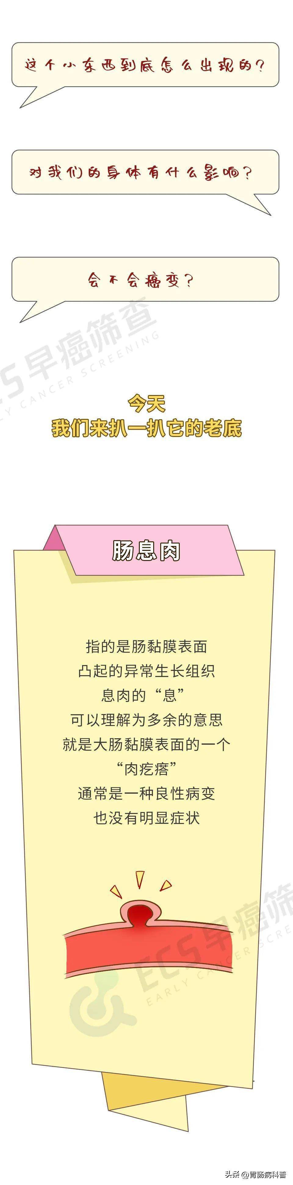 腹脹,排便習慣改變,腹瀉和出血,巨大息肉可導致腸