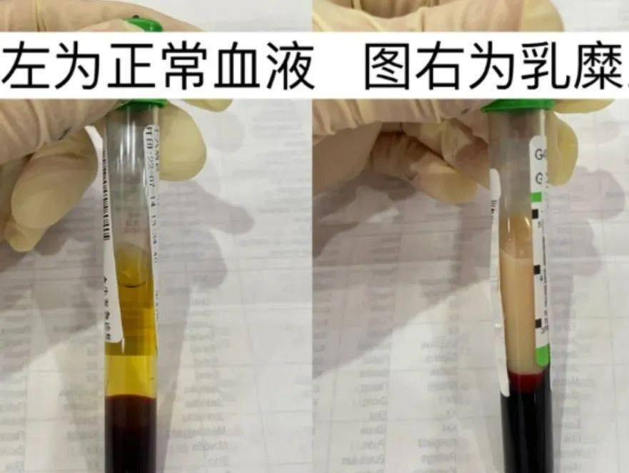 临汾市中心血站【冬季行动】宣传栏(六十四)春节期间!