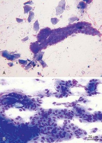 9张镜检图片总结粪便检查中的正常发现:酵母菌,植物
