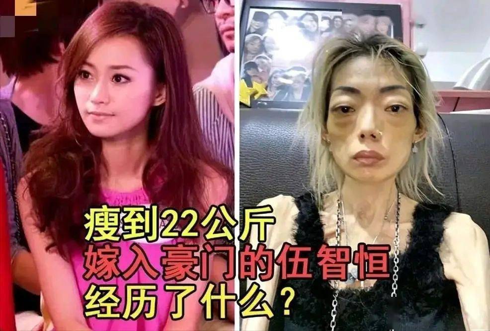 嫩模嫁给"永安百货太子爷",结婚8年,做10次肠胃切除手术,瘦到44斤后