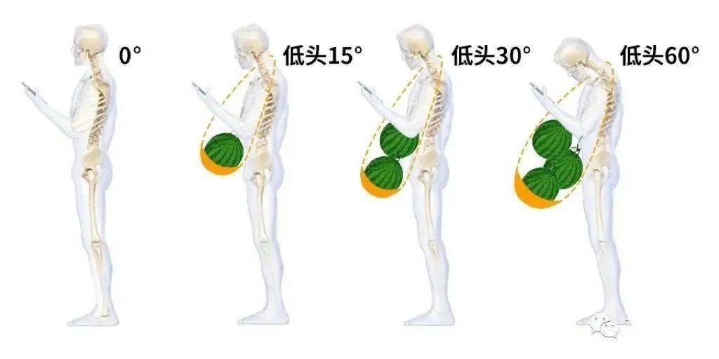 每天低头看手机4小时,危害竟然这么大!低头族必看