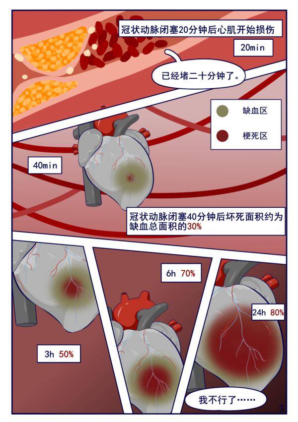 认识心肌梗死,关键时刻挽救生命
