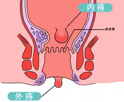 益母草艾绒坐灸垫,买 1 送 1