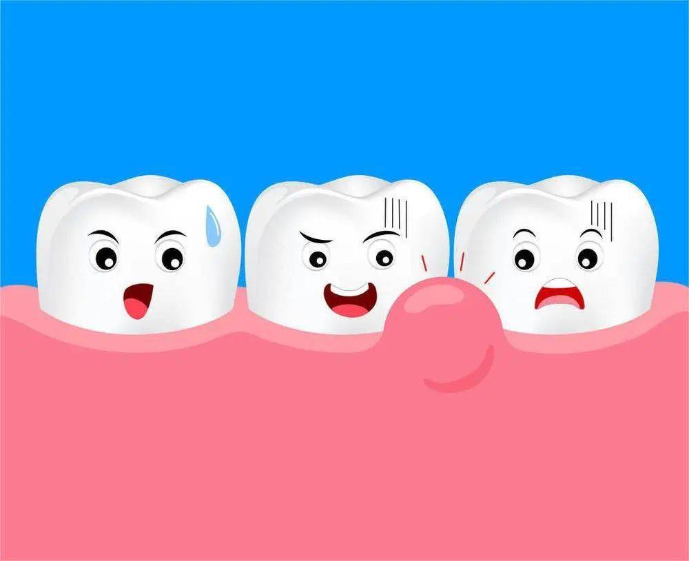 牙龈肿痛不一定是上火,可能是患了根尖周炎!_治疗_咬合_炎症