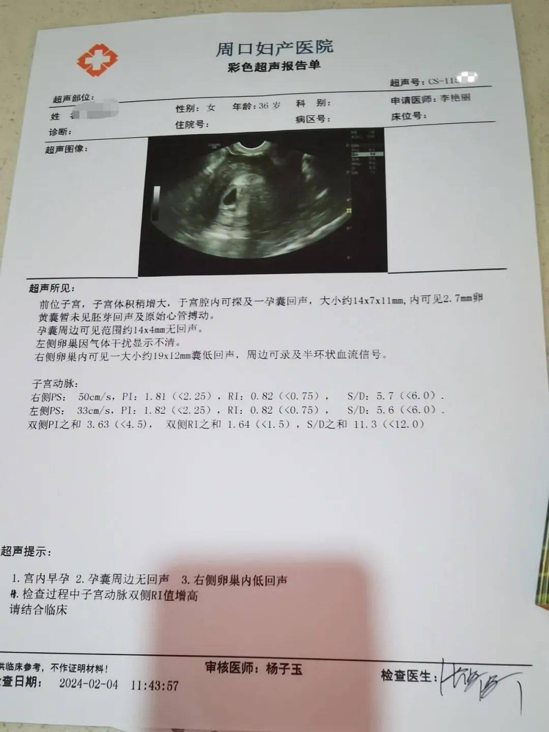 输卵管报告单图片图片