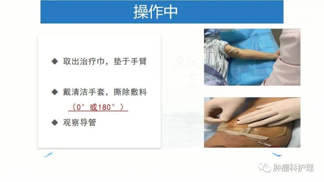 捣管手法