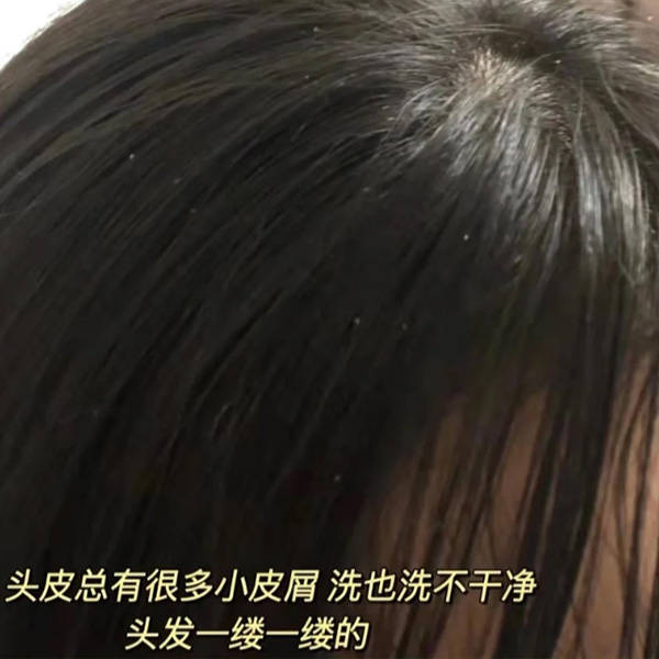 国产十大好用洗发水_头皮_头发_包装