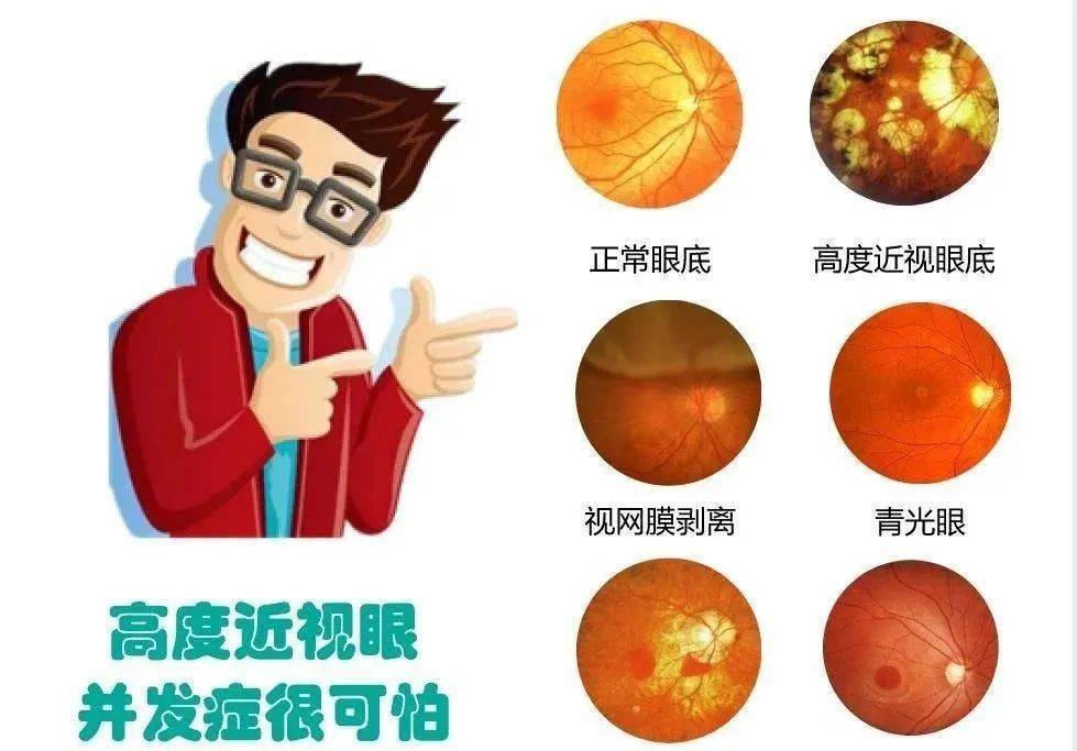 为什么说高度近视很可怕?如何识别是否已"升级"成高度近视?_防控_秘籍