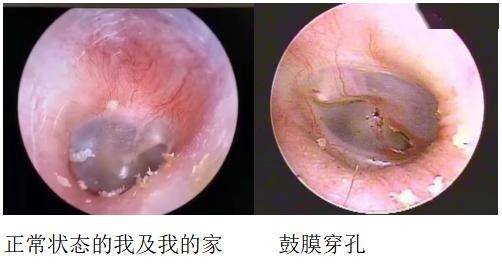 医院取耵聍一次多少钱图片