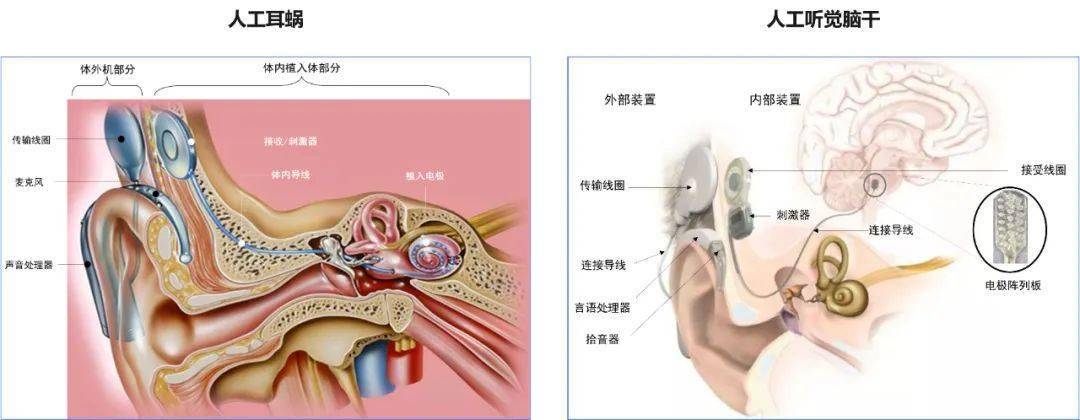 耳蜗的位置图图片