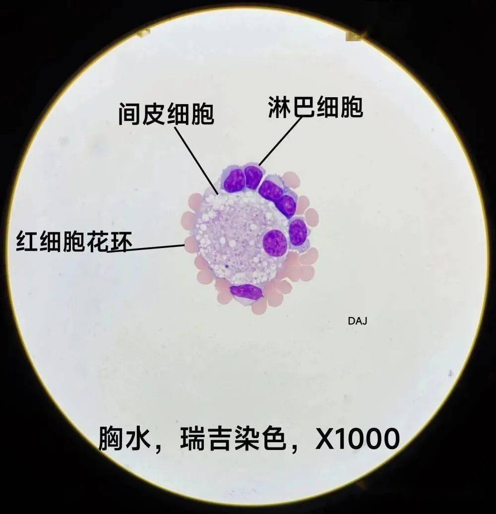 间皮细胞形态图片