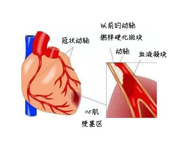 警惕桐乡90后已出现