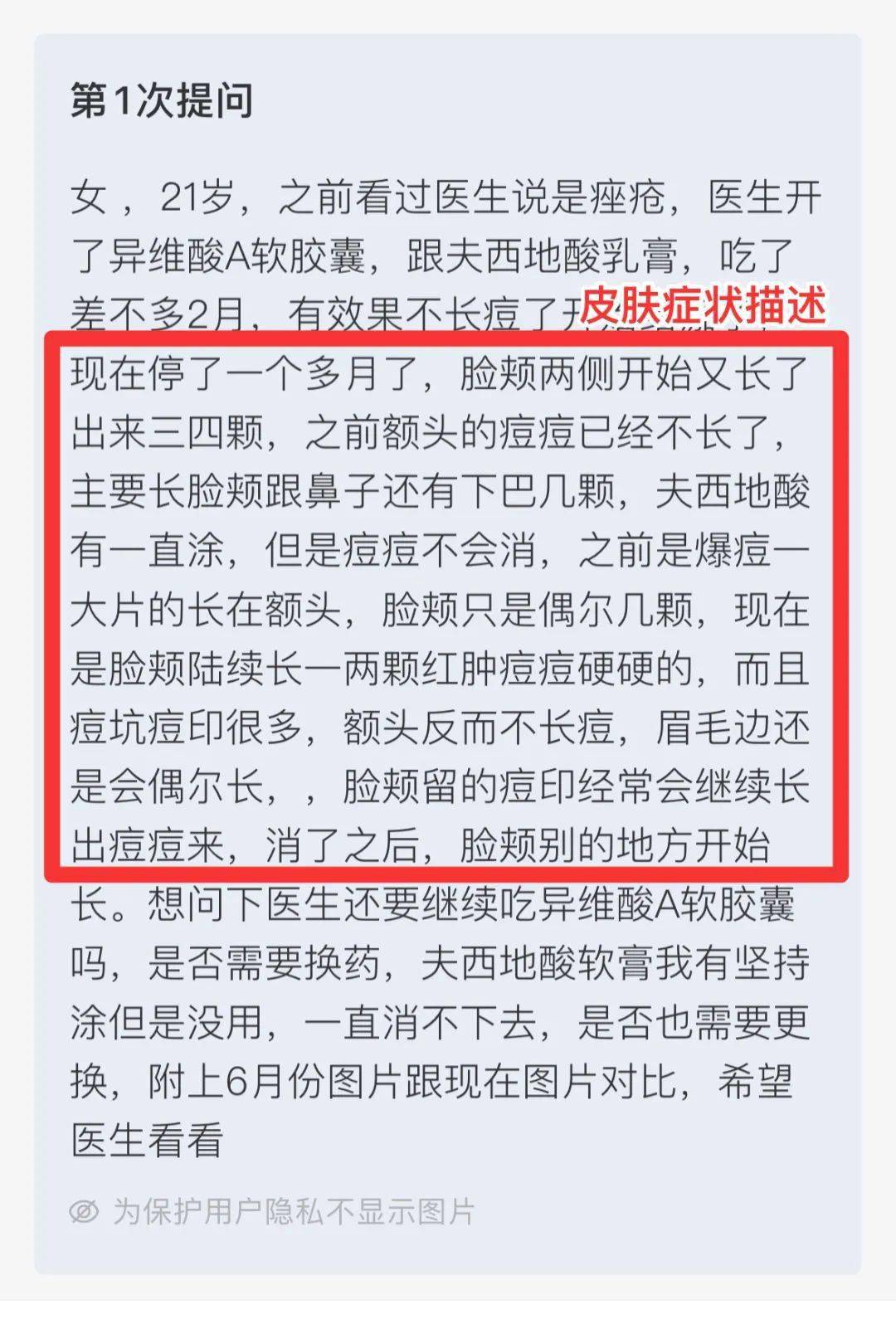 医生_痘痘_治疗