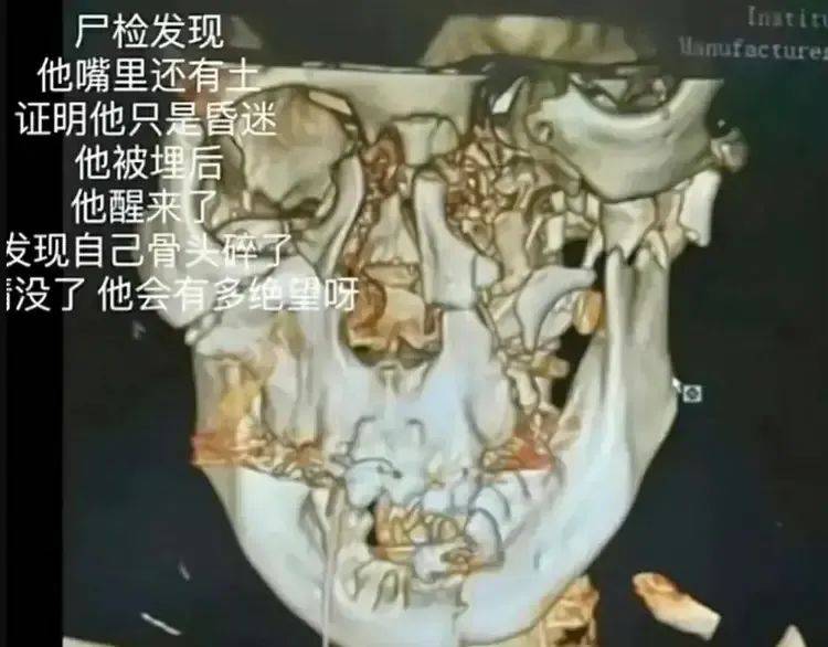 邯郸遇害初中生已尸检,父亲见证全程,"比想象的还要残忍……"