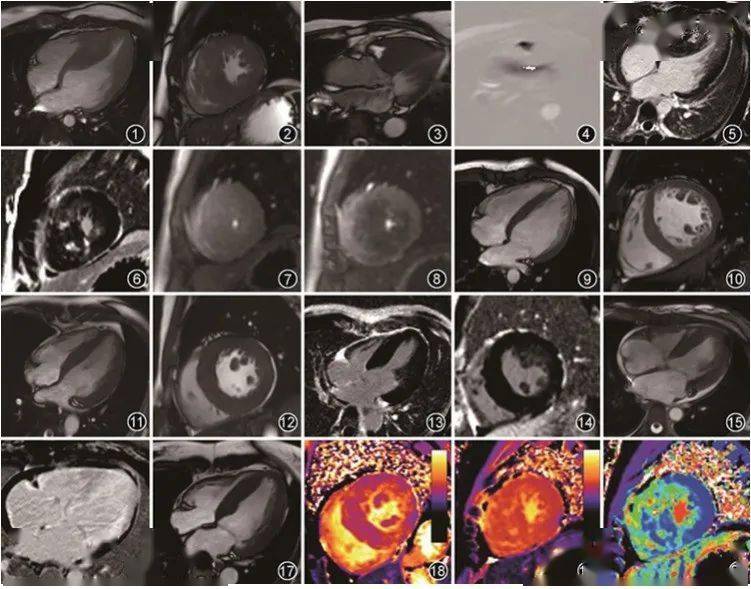 心肌纵断面图片