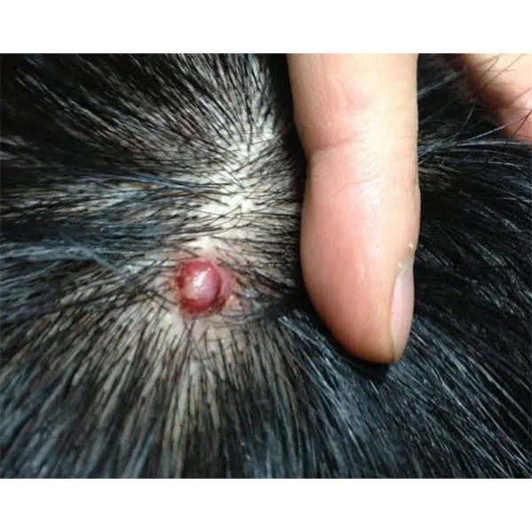 头皮屑毛囊炎等头皮问题产生的原因:大块头屑,头痒,毛囊炎,小红疹和