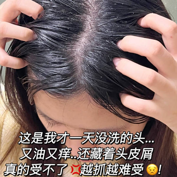 头皮_头发_问题
