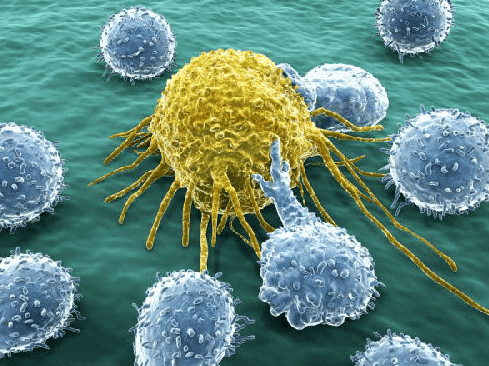 肿瘤_癌细胞_治疗