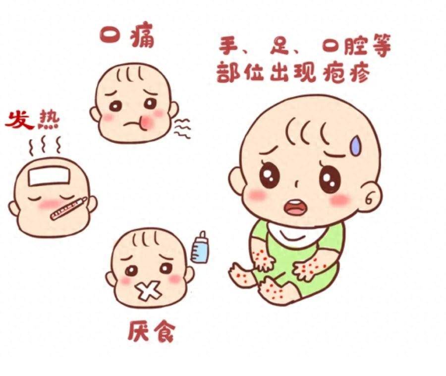 手足口病高发季来临应如何预防