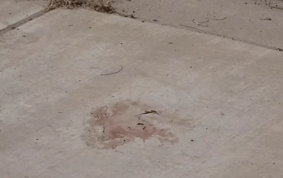 恐怖慎点人吃人男子当街挥舞死人腿直接生啃路人吓疯惊悚视频曝光澳两